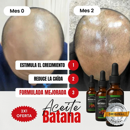 Aceite de Batana Premium 2 en 1 – Tratamiento Capilar Reparación y Crecimiento Capilar